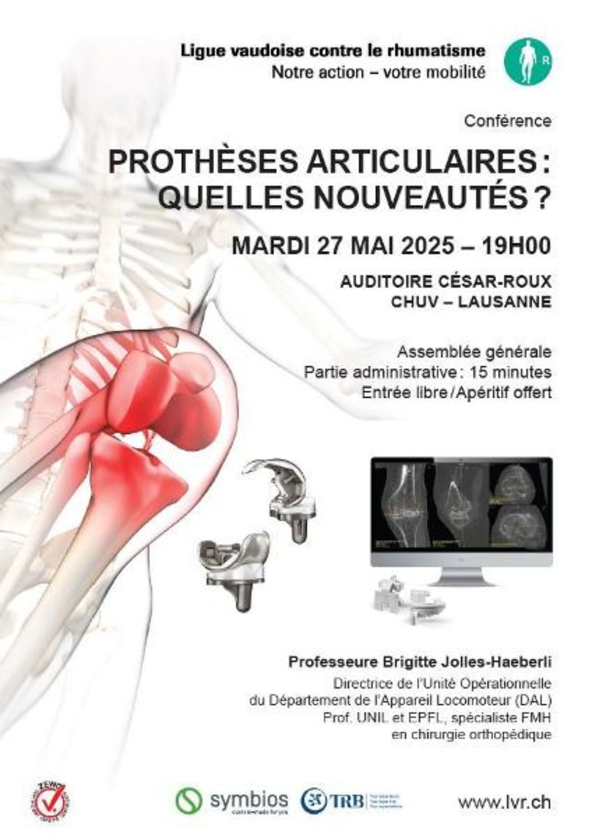 Prothèses articulaires: quelles nouveautés?
